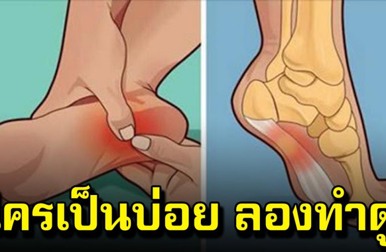 เจ็บ ส้นเท้ า ฝ่าเท้า ใน ตอนเ ช้าหรือตอนที่ลุกขึ้นยืน ลองทำดู