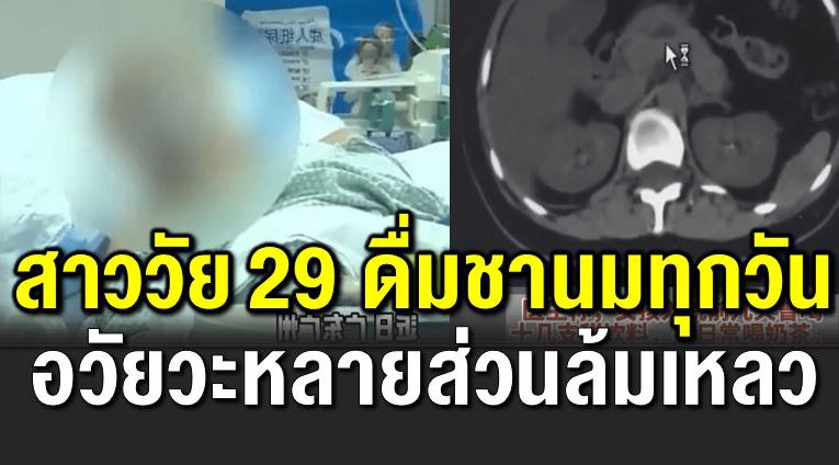 สาววัย 29 ดื่มชาน มทุกวัน ถูกห ามเข้าไอซียู