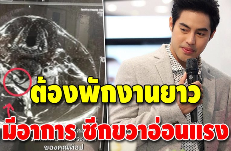 แฟนคลับแห่ส่งกำลังใจ หลัง “ท็อป จรณ” ซีกซีกขวาอ่อนแรง