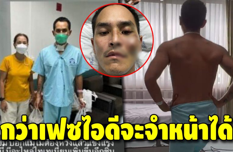 สงกรานต์ เผยภาพหลังเข้าไอซียู 7 วัน พร้อมเปิดการ์ดกำลังใจจาก แอฟ